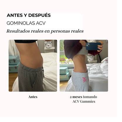 Gominolas Vinagre de Mazana para el Hinchazón | VidaLux™ - PARCHES de REGALO