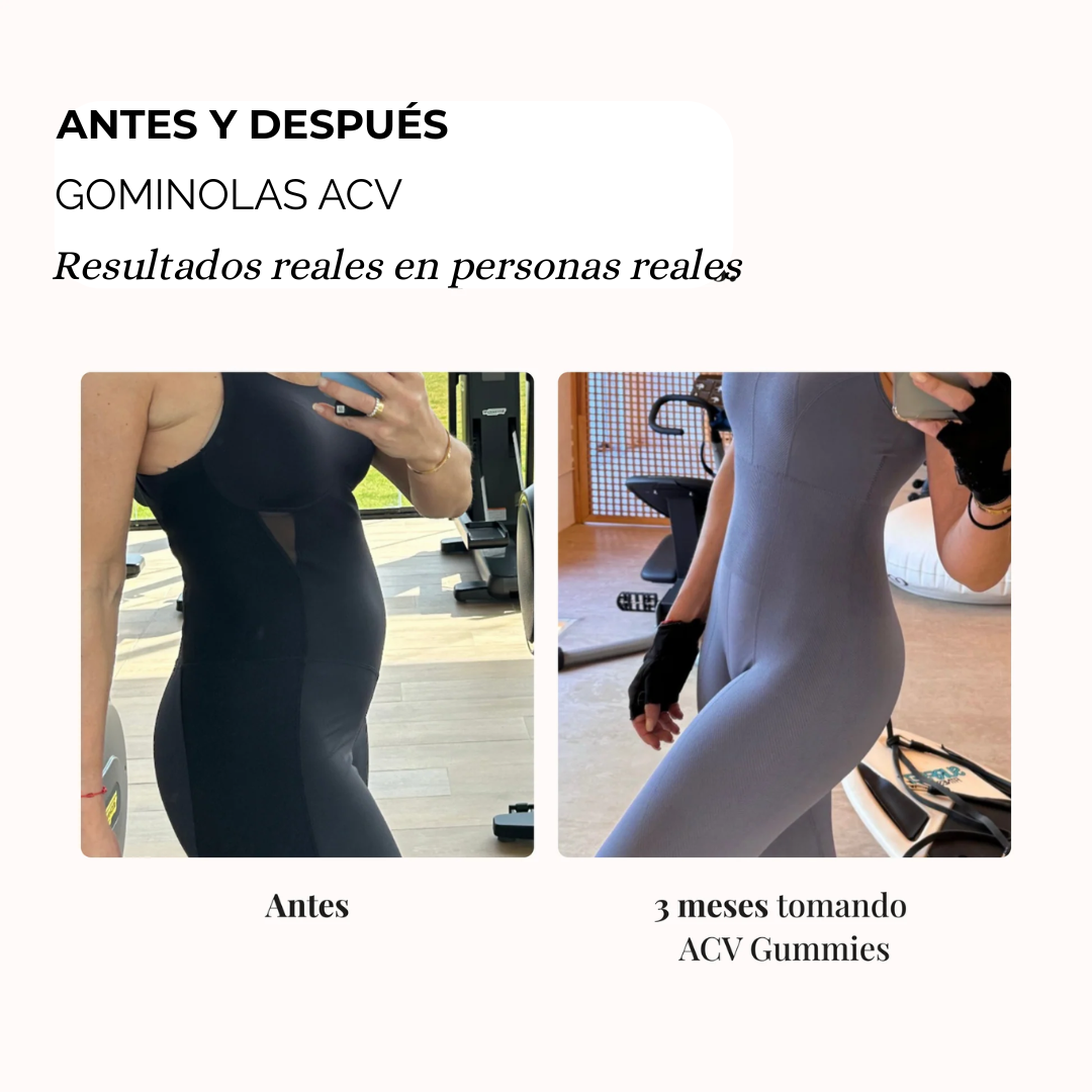 Gominolas Vinagre de Mazana para el Hinchazón | VidaLux™ - PARCHES de REGALO